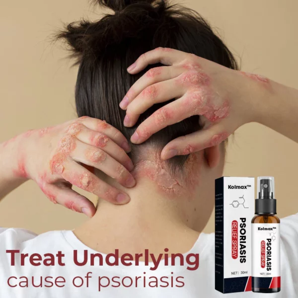 Kolmax ™ Psoriasis Relief Spray