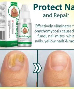 NailRestore Anti-Fungal Treatment Essence