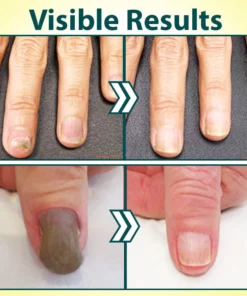 NailRestore Anti-Fungal Treatment Essence