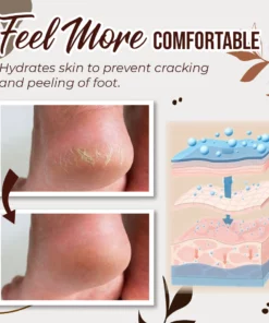 Premium Anti-Fungal Treatment Spray