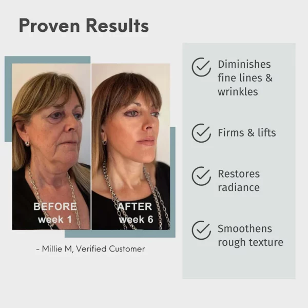 REN™ Advanced Collagen Boost Serum protiv starenja