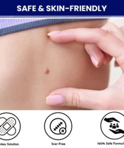 WartsoffPRO Removal Ointment