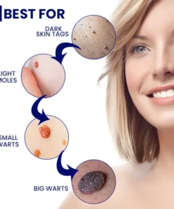 WartsoffPRO Removal Ointment