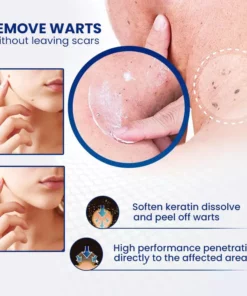 WartsoffPRO Removal Ointment