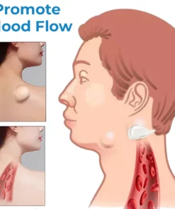 CurSkin™ Lipoma Treatment Ointment