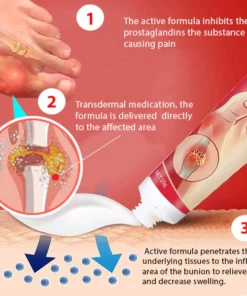 Mendex™ Bunion Relief Cream
