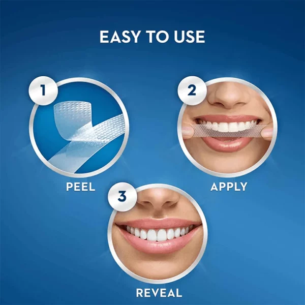 5D-strips voor het bleken van tanden