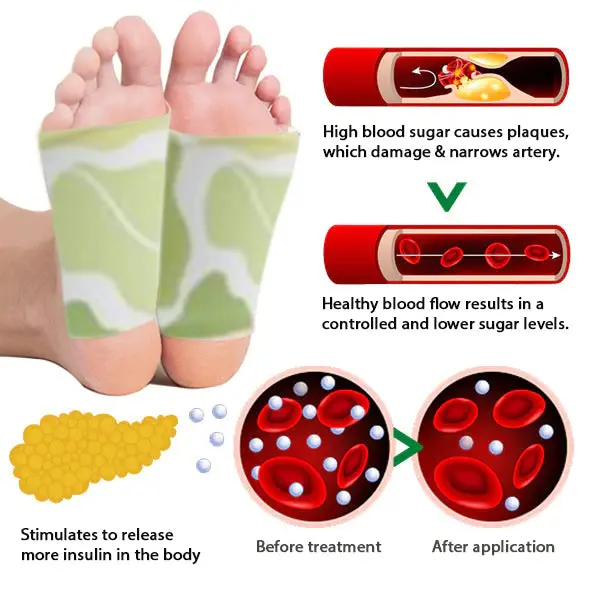 ANLOMARE™ kāju spilventiņi, kas samazina cukura līmeni asinīs un taukus