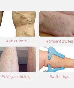 AUQUEST™ Varicose Veins Relief Cream