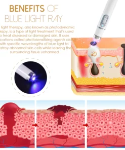 Akemi WartRemover LightTherapie Professional Kit