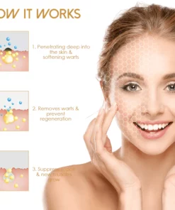 Akemi WartRemover LightTherapie Professional Kit