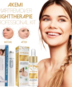 Akemi WartRemover LightTherapie Professional Kit