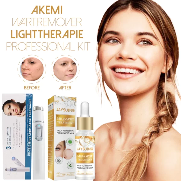 Akemi WartRemover LightTherapie Professional Kit