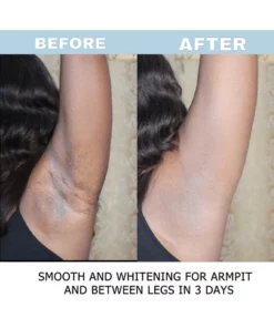 BELLEZON™ Body Care Brightening Cream