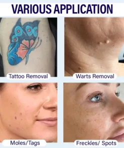 CalmSkin™ Spots Removal Pen