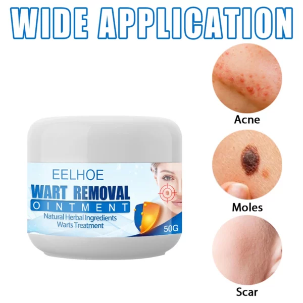 Clearasil™ Creme zur Entfernung von Petechien