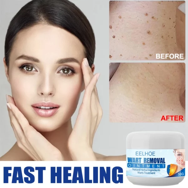 Clearasil™ Petechiae റിമൂവൽ ക്രീം