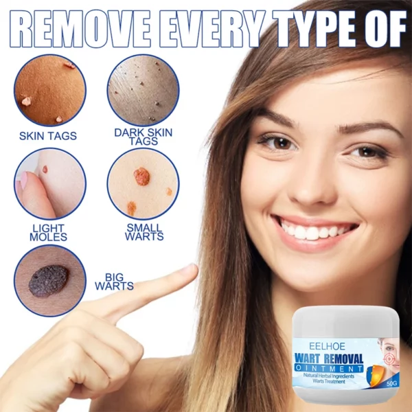 I-Clearasil™ Petechiae Removal Cream