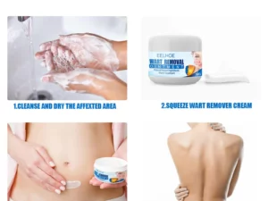 Clearasil™ Petechiae Removal Cream