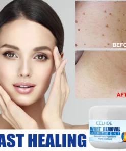 Clearasil™ Petechiae Removal Cream