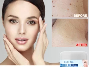 Clearasil™ Petechiae Removal Cream