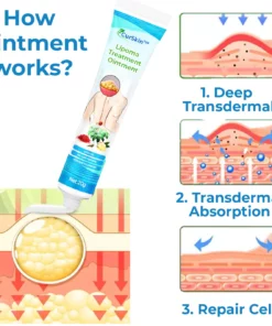 CurSkin™ Lipoma Treatment Ointment
