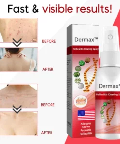 Dermax™ Folliculitis Clearing Spray