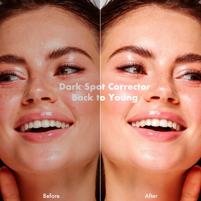 ENVISHA™ Dark Spot And Acne Corrector Cream