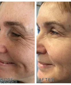 EyeDevelo NeoGlucosamine Active Eye Cream