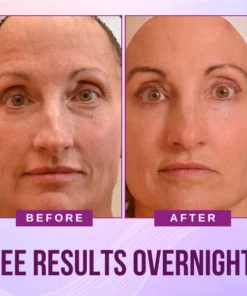 FaceLift™ Anti-wrinkle Patch