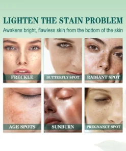 Faues™ Skin Brightening Anti-Spot Serum