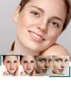 Faues™ Skin Brightening Anti-Spot Serum