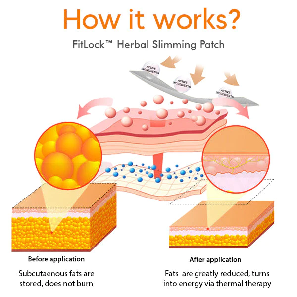 I-FitLock™ Herbal Slimming Patch