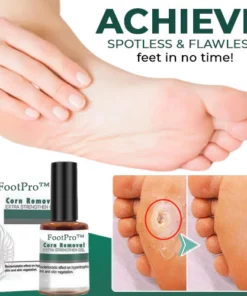 FootPro™ Corn Removal Extra Strengthen Gel