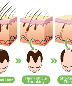 GerminalOil Ginger Hair Regrowth Serum