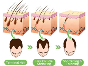 GerminalOil Ginger Hair Regrowth Serum