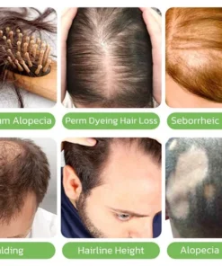 GerminalOil Ginger Hair Regrowth Serum