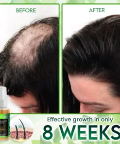 GinCare Hair Nutrition Spray