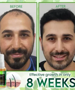 GinCare Hair Nutrition Spray