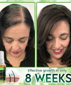 GinCare Hair Nutrition Spray