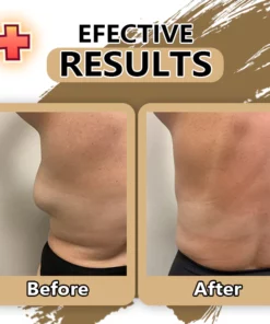 Girlsholytale™ Lipoma Removal moxibustion liquid