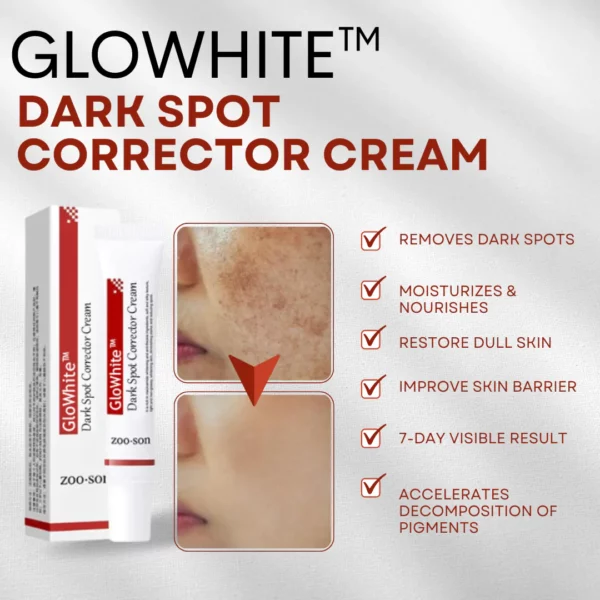 GloWhite ™ Dark Spot Corrector Cream