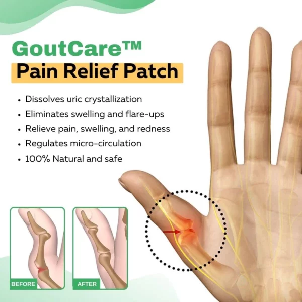 GoutCare™ flaster za ublažavanje bolova