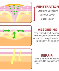HOLO Medical Wart Removal Cream