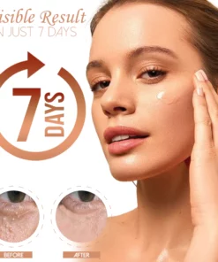 HerbPRO Milia FatGranules Reduce Serum