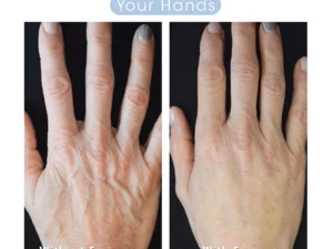 Hyaluronic Acid Hand Moisture Essence