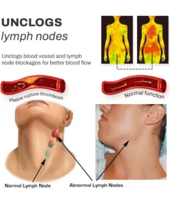 InvoPro Ultrasonic LymphDetox NeckInstrument