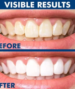 IonicWhite™ Teeth Whitening Essence