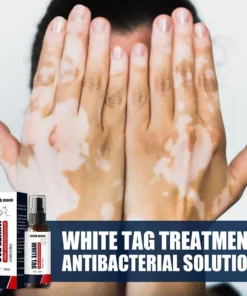 Kolmax™ Vitiligo Relief Spray