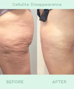 Korean FirmSkin™ Slimming Gel